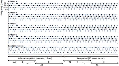 Stimulus Phase Locking of Cortical Oscillations for Rhythmic Tone Sequences in Rats